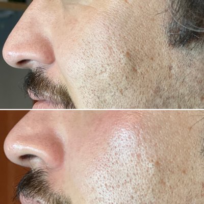 Mirame Skin Treatments by null