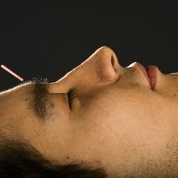 North Shore Chinese Medicine - Insomnia? Anxiety? Depression?
Stress?
Acupuncture and Chinese medicine can help.