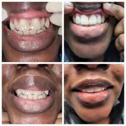 Inglewood Family Dental Care - Other Happy Patient thank you for trusting us.