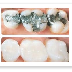 Stephen J Rubinkan, DDS APC - Before and after