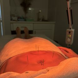 Shifeng Yan, AP, LAC - Ivy Acupuncture & Medicine Clinic - Acupuncture