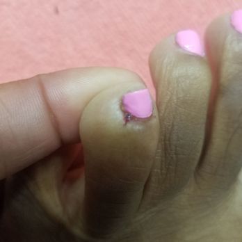 Oasis Nail Lounge - How my toe looks today (7-14-23) after Amy cut me last night (7-13-23)!!! Amy never apologized!!! - Nail Salons Near Me - Houston, Texas Oasis Nail Lounge - How my toe looks today (7-14-23) after Amy cut me last night (7-13-23)!!! Amy never apologized!!! - Nail Salons Near Me - Houston, Texas