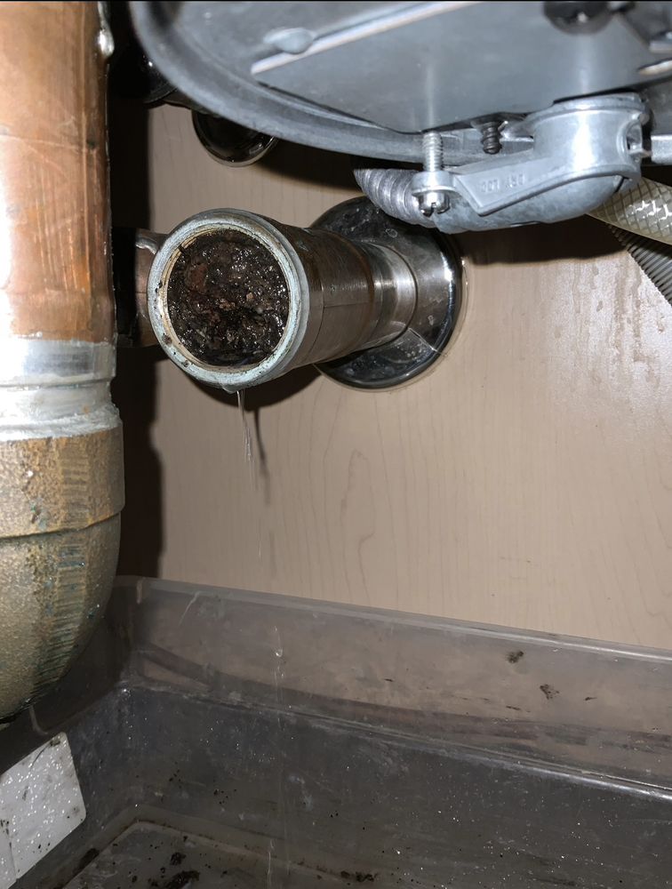 Slide of Drain Pains