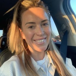 Picture is two days post morpheus treatment-skin is vibrant!