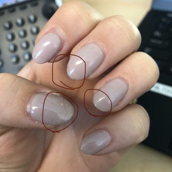 Pearl Nails & Spa - Cracked thumb and middle finger, ring finger had cracked and been filed down. - Nail Salons Near Me - Carlsbad, California Pearl Nails & Spa - Cracked thumb and middle finger, ring finger had cracked and been filed down. - Nail Salons Near Me - Carlsbad, California