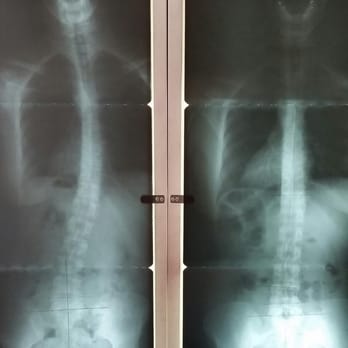 Life Wellness Chiropractic - Health happens one adjustment at a time. - Chiropractors Near Me - Moses Lake, Washington Life Wellness Chiropractic - Health happens one adjustment at a time. - Chiropractors Near Me - Moses Lake, Washington