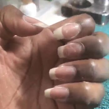Fancy Nails & Spa - Before acrylic overlay and just natural nails - Nail Salons Near Me - Chelsea, Massachusetts Fancy Nails & Spa - Before acrylic overlay and just natural nails - Nail Salons Near Me - Chelsea, Massachusetts