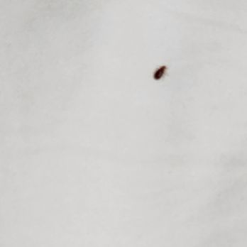 Best Motel - A bed bug and the bites I received - Hotels Near Me - Sylmar, California