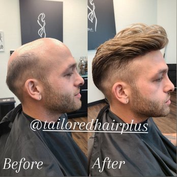 Tailored Hair Plus - Thin skin hair replacement systems for men can rebuild your confidence immediately!! Look ten years younger with more hair. - Hair Loss Centers Near Me - Phoenix, Arizona Tailored Hair Plus - Thin skin hair replacement systems for men can rebuild your confidence immediately!! Look ten years younger with more hair. - Hair Loss Centers Near Me - Phoenix, Arizona