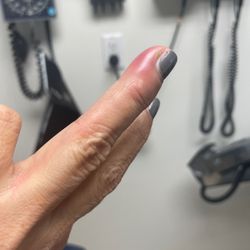 Les Mains Nail Bar - Infection in nail requires treatment with antibiotics and drainage