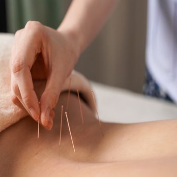 Spa Dew & Acupuncture - Acupuncture for Lower Back Pain and more - Day Spas Near Me - Fort Lee, New Jersey Spa Dew & Acupuncture - Acupuncture for Lower Back Pain and more - Day Spas Near Me - Fort Lee, New Jersey
