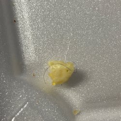 Mega Tom's Burgers - A hair was cooked into my egg