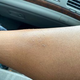 My leg after pedicure!!! Nicole didn't even get everything off my legs!!! My leg after pedicure!!! Nicole didn't even get everything off my legs!!!