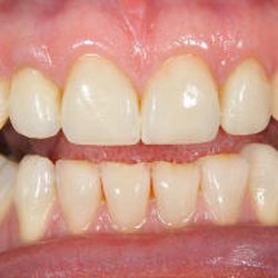 Family Dental Care Of New Castle