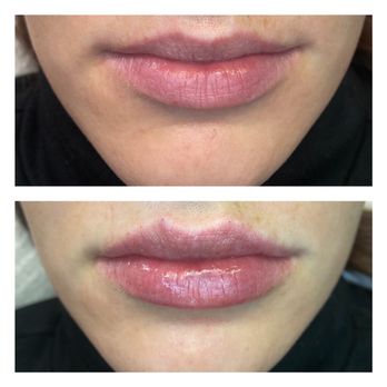 RBF PDX - Aestheticians Near Me RBF PDX - Aestheticians Near Me