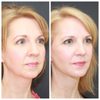Nayak Plastic Surgery gift card