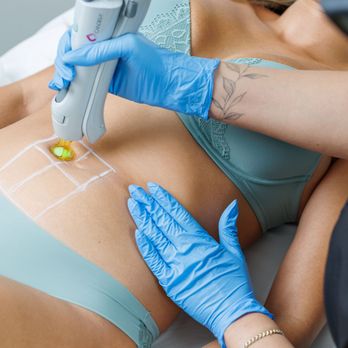 Milan Laser Hair Removal - Laser Hair Removal Near Me - Duluth, Georgia Milan Laser Hair Removal - Laser Hair Removal Near Me - Duluth, Georgia