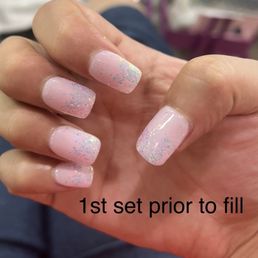 1 week ago after nails were first done. Too bulky. You can see a small gap left in the thumb not going all the way to the end of the nail. 1 week ago after nails were first done. Too bulky. You can see a small gap left in the thumb not going all the way to the end of the nail.