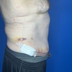 Joshua A. Halpern, M.D. P.A