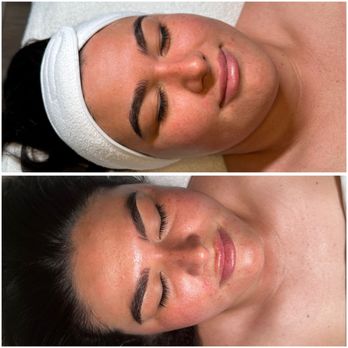 Opal Esthetics - Eyelash Service Near Me - Santa Barbara, California
