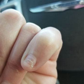 Majestic Nail Bar - Three weeks later, my pinky nail is starting to grow back after breaking off completely. They butchered my nails! - Nail Salons Near Me - Richmond, Texas Majestic Nail Bar - Three weeks later, my pinky nail is starting to grow back after breaking off completely. They butchered my nails! - Nail Salons Near Me - Richmond, Texas