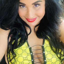 Breast augmentation