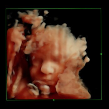 Baby View HD - Photographers Near Me - Mansfield, Texas Baby View HD - Photographers Near Me - Mansfield, Texas