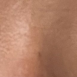 Sad nonexistent eyelashes Sad nonexistent eyelashes