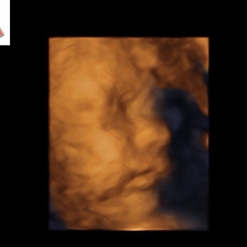 Hey Baby 3D/4D Sonogram Studio - Our 3D images we got - Ultrasound Imaging Centers Near Me - Salem, Utah