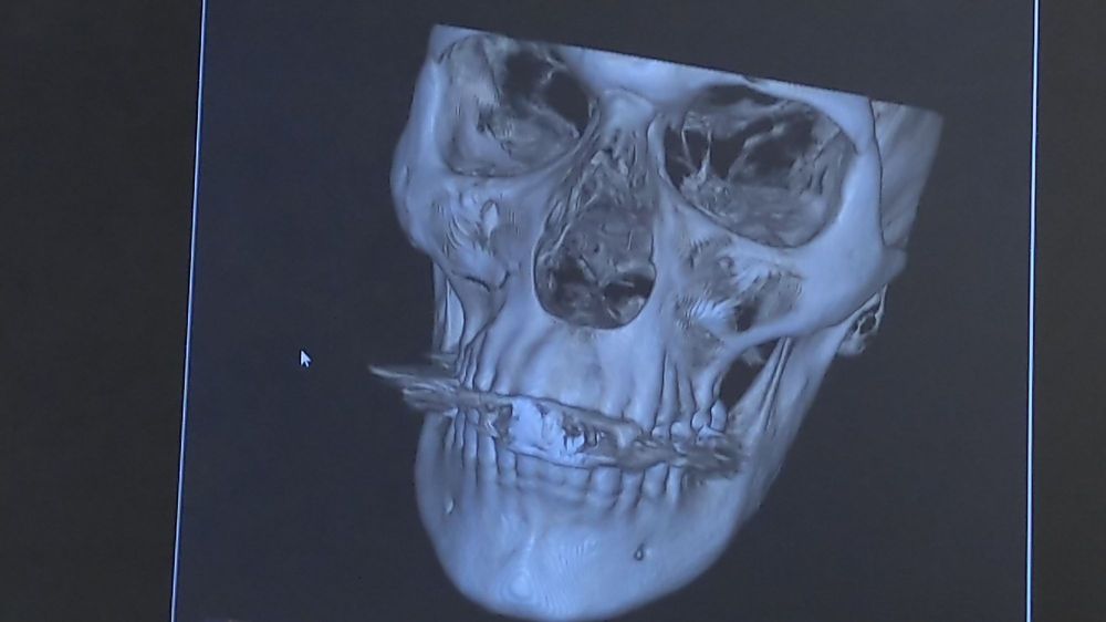 Baptist Health Baptist Hospital - patient advocate in Miami, FL