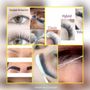 Photo of Shapes Of Eye