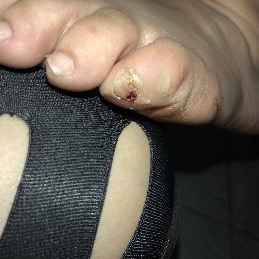 T's Nails & Spa - I will be contacting the The Department of Consumer Affairs the worst service ever they cut me and pour crazy glue on my my toe was in pain - Nail Salons Near Me - Stanton, California