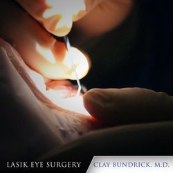 Clay Bundrick, MD - Highland Clinic - Considered LASIK before?