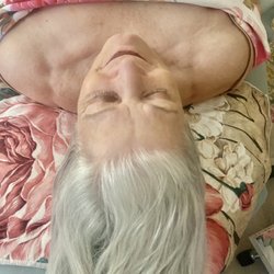Facials By Pearl - Before photo of client who received a Lightwave Led, facial cupping, face massage and oxygen atomizer infusion. See after pic!!