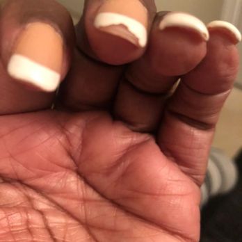 Queen Nails - This is how my nails look with GEL after one day. I am so mad $45 down the drain. Horrible Job. - Nail Salons Near Me - Irvington, New Jersey Queen Nails - This is how my nails look with GEL after one day. I am so mad $45 down the drain. Horrible Job. - Nail Salons Near Me - Irvington, New Jersey