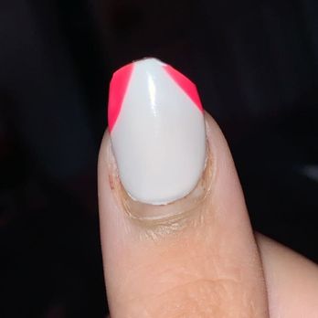 VIP Nail & Spa - my nail before it fell off. - Nail Salons Near Me - Kokomo, Indiana VIP Nail & Spa - my nail before it fell off. - Nail Salons Near Me - Kokomo, Indiana