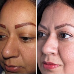 Bosley Hair Restoration & Transplant - Eyebrow restoration before & after