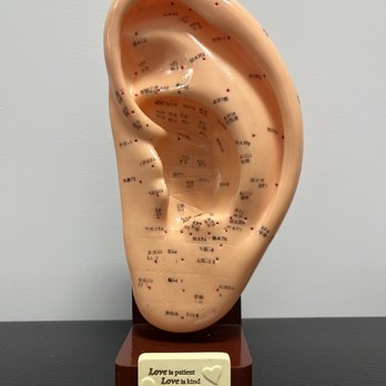 Bakersfield Acupuncture Clinic - Ear acupuncture Points - Acupuncture Near Me - Bakersfield, California Bakersfield Acupuncture Clinic - Ear acupuncture Points - Acupuncture Near Me - Bakersfield, California