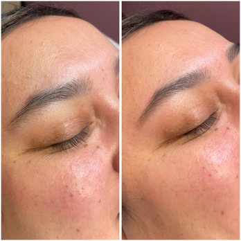 Skin By Corinne - Waxing Near Me - Santee, California Skin By Corinne - Waxing Near Me - Santee, California