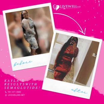 Live Well MD - Weight Loss Centers Near Me - Temecula, California