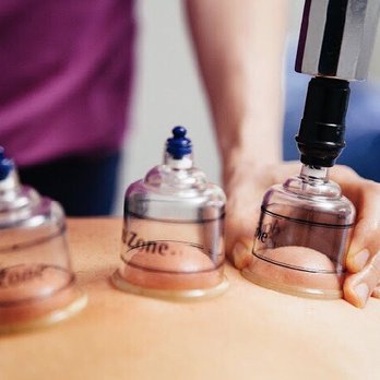 Centered on North - Cupping wellness services offered - Pilates Near Me - Chicago, Illinois