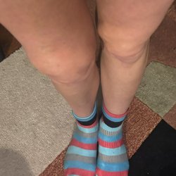Nashville Knee & Shoulder Center - Dr Jason Jones Meniscus Surgery - Aftermath...  16 months out. Internal bleeding ,over a year.