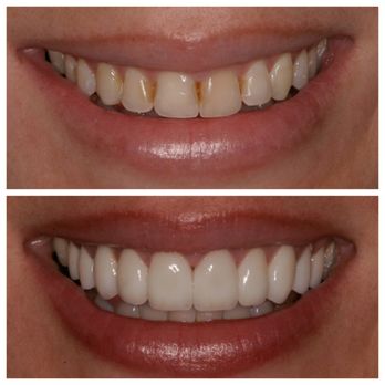Matt McGee Family and Cosmetic Dentistry - General Dentistry Near Me - Nashville, Tennessee