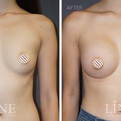 Line Plastic Surgery Center  - Koreatown
