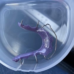 Dr. Wes Orthodontics - Hawley Retainer with purple sparkle!