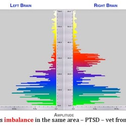 Brain Fitness - Brain Optimization takes care of the imbalance in the brain