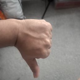 A bad thumb down!