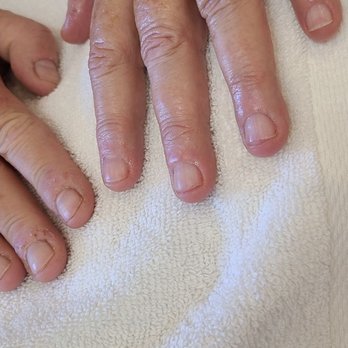Professional Nails - My before and after. - Nail Salons Near Me - Laguna Hills, California Professional Nails - My before and after. - Nail Salons Near Me - Laguna Hills, California