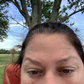 Cosmetic Injections by Sarah - One week later - Skin Care Near Me