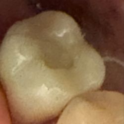 Dowiatt Dental - Craig Dowiatt, DDS - Failed dentistry